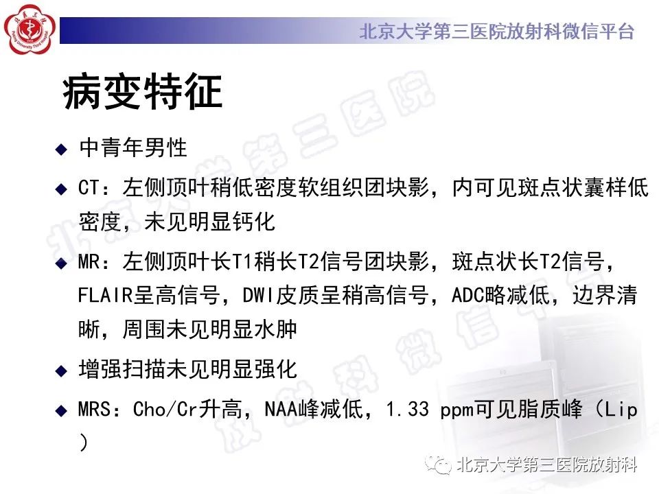 影像PPT - 【PPT】少突胶质细胞瘤-9