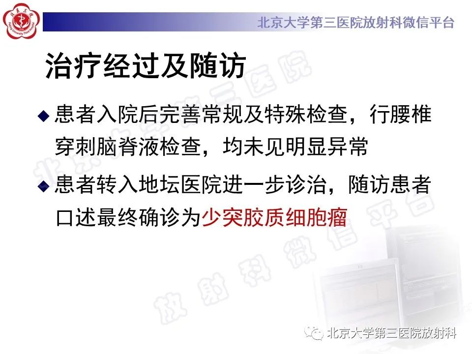 影像PPT - 【PPT】少突胶质细胞瘤-10
