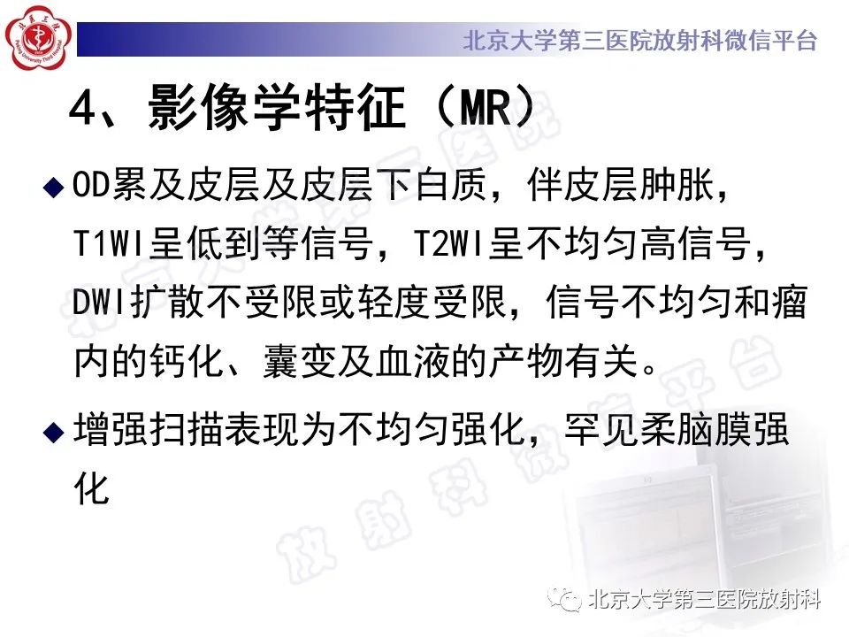 影像PPT - 【PPT】少突胶质细胞瘤-17