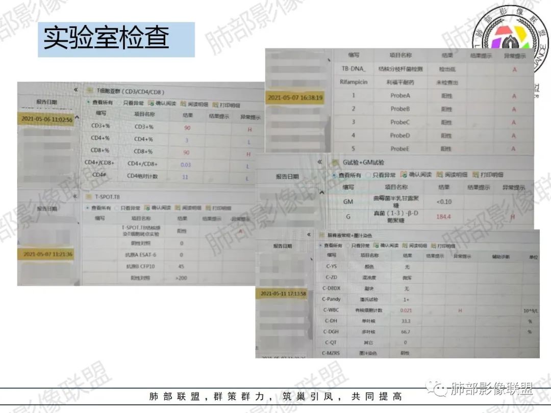 影像PPT - 【病例】HIV相关,肿瘤还是感染?-5 影像PPT - 【病例】HIV相关,肿瘤还是感染?-5