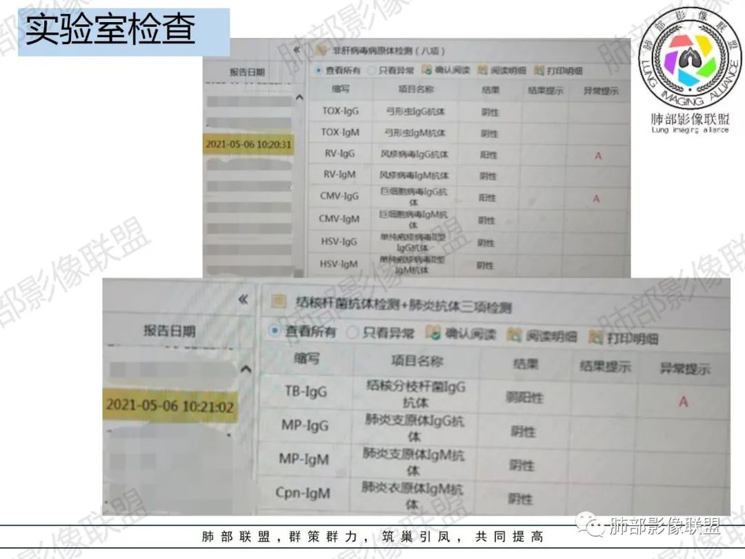 影像PPT - 【病例】HIV相关,肿瘤还是感染?-4 影像PPT - 【病例】HIV相关,肿瘤还是感染?-4