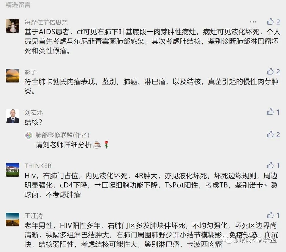 影像PPT - 【病例】HIV相关,肿瘤还是感染?-25 影像PPT - 【病例】HIV相关,肿瘤还是感染?-25