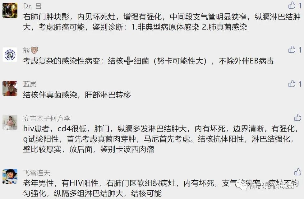 影像PPT - 【病例】HIV相关,肿瘤还是感染?-24 影像PPT - 【病例】HIV相关,肿瘤还是感染?-24