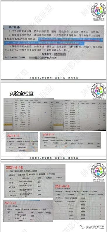 影像PPT - 【病例】HIV相关,肿瘤还是感染?-55 影像PPT - 【病例】HIV相关,肿瘤还是感染?-55