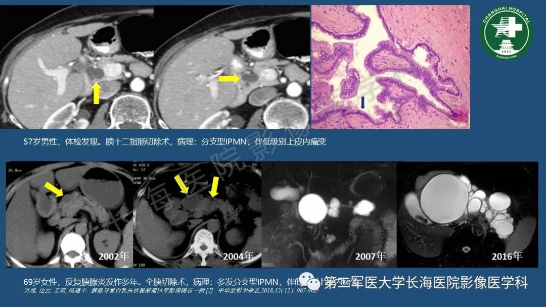 影像PPT - 【PPT】胰腺影像诊断在临床决策中的意义及常见误诊病种-18