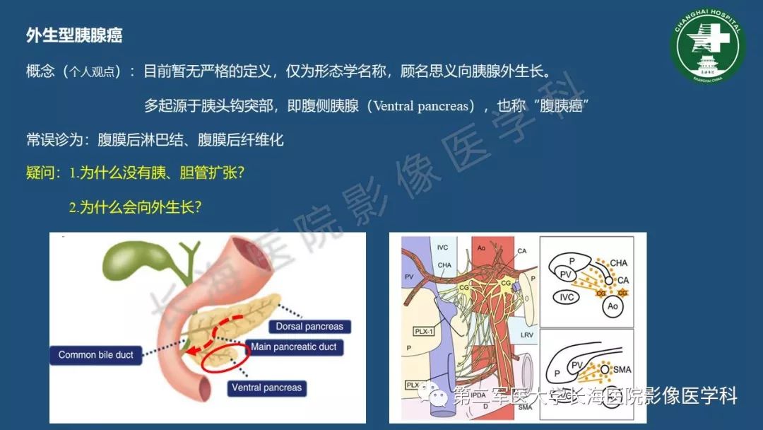 影像PPT - 【PPT】胰腺影像诊断在临床决策中的意义及常见误诊病种-27