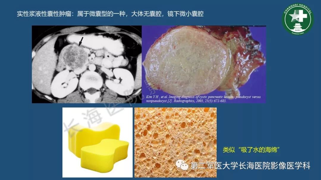 影像PPT - 【PPT】胰腺影像诊断在临床决策中的意义及常见误诊病种-39