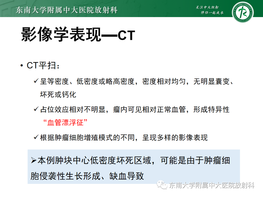影像PPT - 【PPT】肾脏淋巴瘤-11