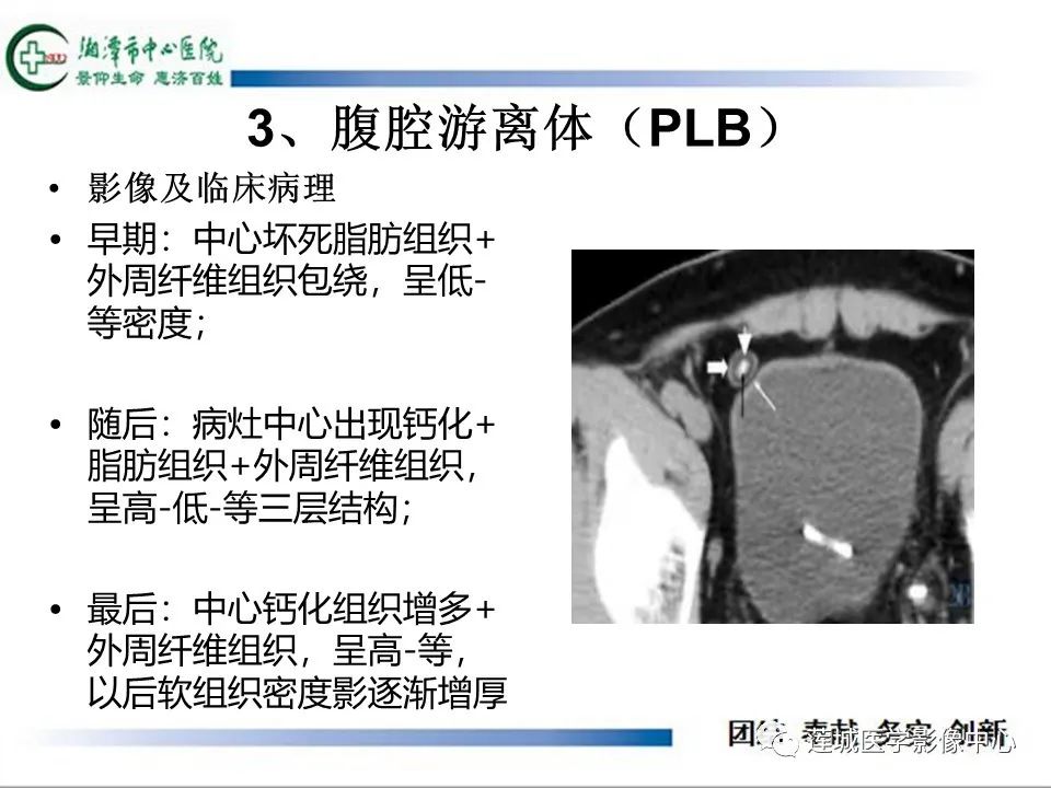 影像PPT - 【PPT】腹腔寄生胎影像表现-22