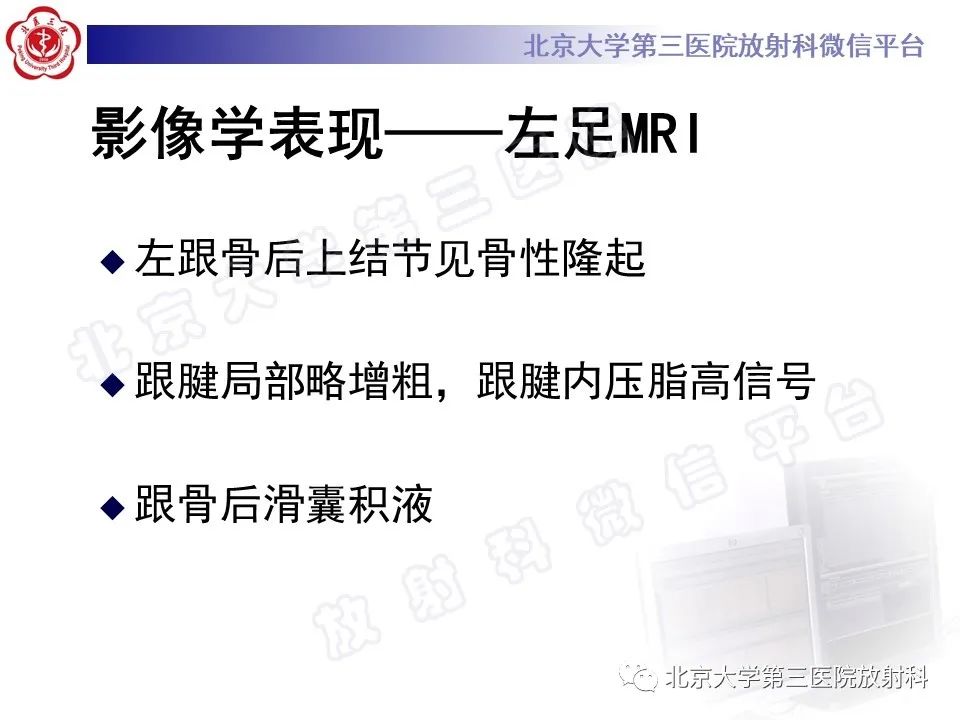 影像PPT - 【PPT】HUGLUND综合征-5