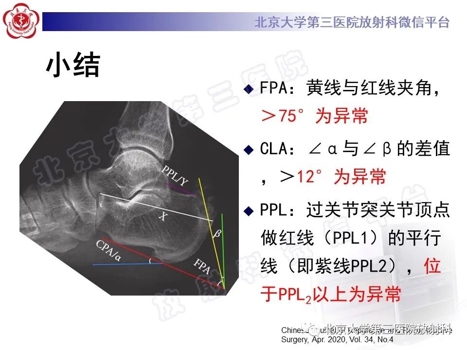 影像PPT - 【PPT】HUGLUND综合征-23