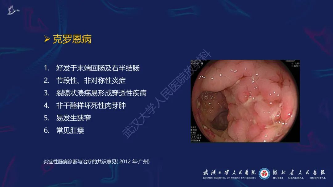 影像PPT - 【PPT】炎症性肠病影像诊断-3