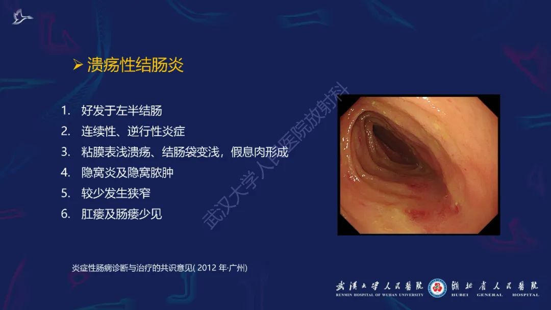 影像PPT - 【PPT】炎症性肠病影像诊断-4