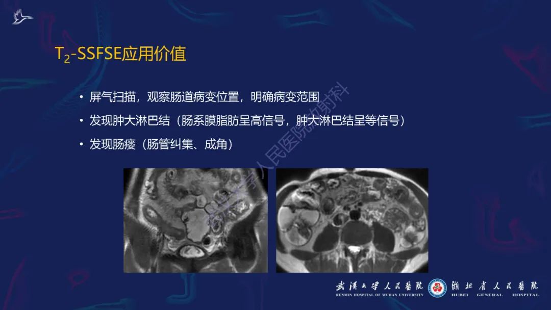 影像PPT - 【PPT】炎症性肠病影像诊断-8