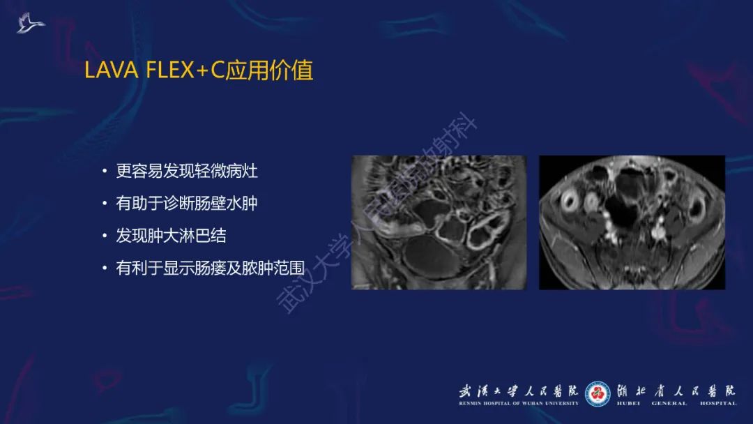 影像PPT - 【PPT】炎症性肠病影像诊断-11