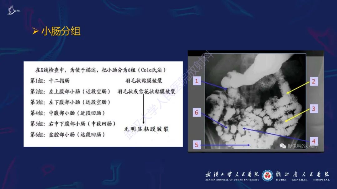 影像PPT - 【PPT】炎症性肠病影像诊断-12