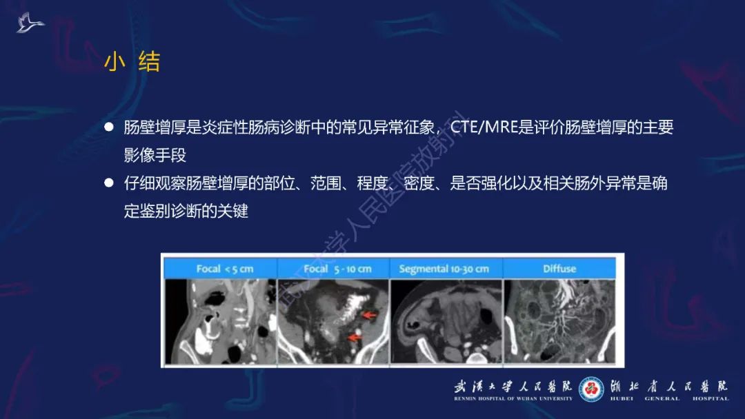 影像PPT - 【PPT】炎症性肠病影像诊断-51