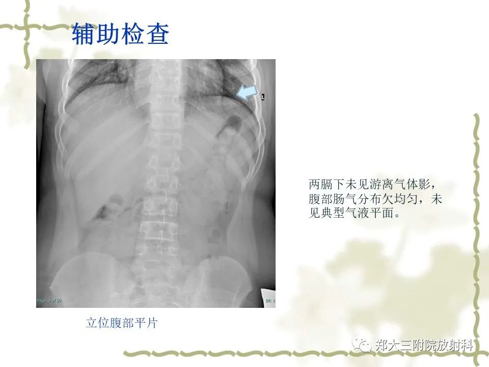 影像PPT - 【病例】贲门失弛缓症1例X线影像诊断-3