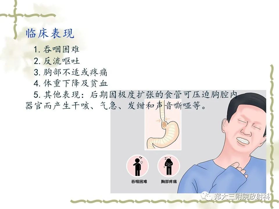 影像PPT - 【病例】贲门失弛缓症1例X线影像诊断-8