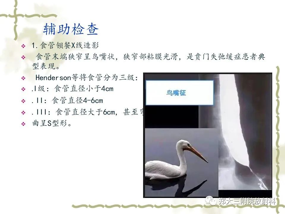 影像PPT - 【病例】贲门失弛缓症1例X线影像诊断-9