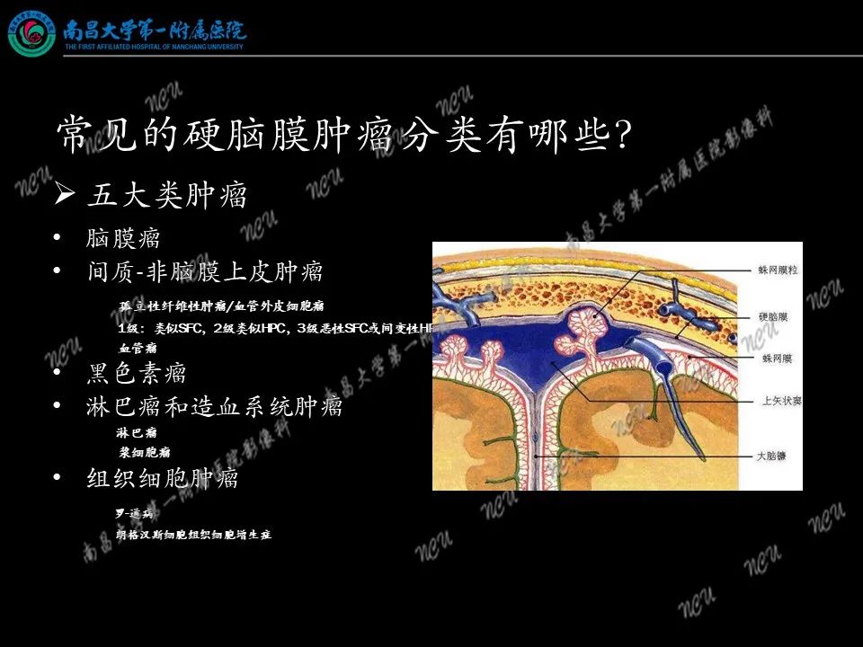 影像PPT - 【PPT】易误诊为脑膜瘤的病例分析-3