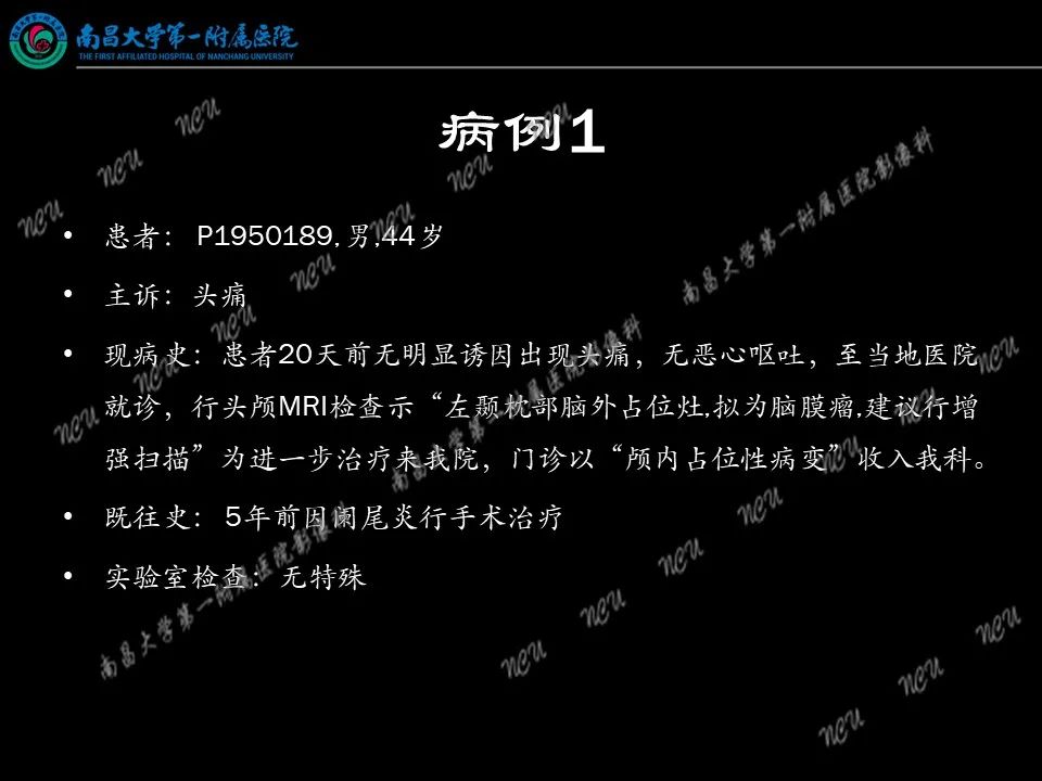 影像PPT - 【PPT】易误诊为脑膜瘤的病例分析-4