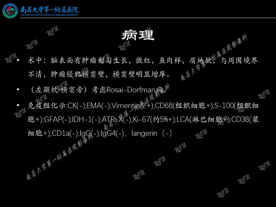 影像PPT - 【PPT】易误诊为脑膜瘤的病例分析-9