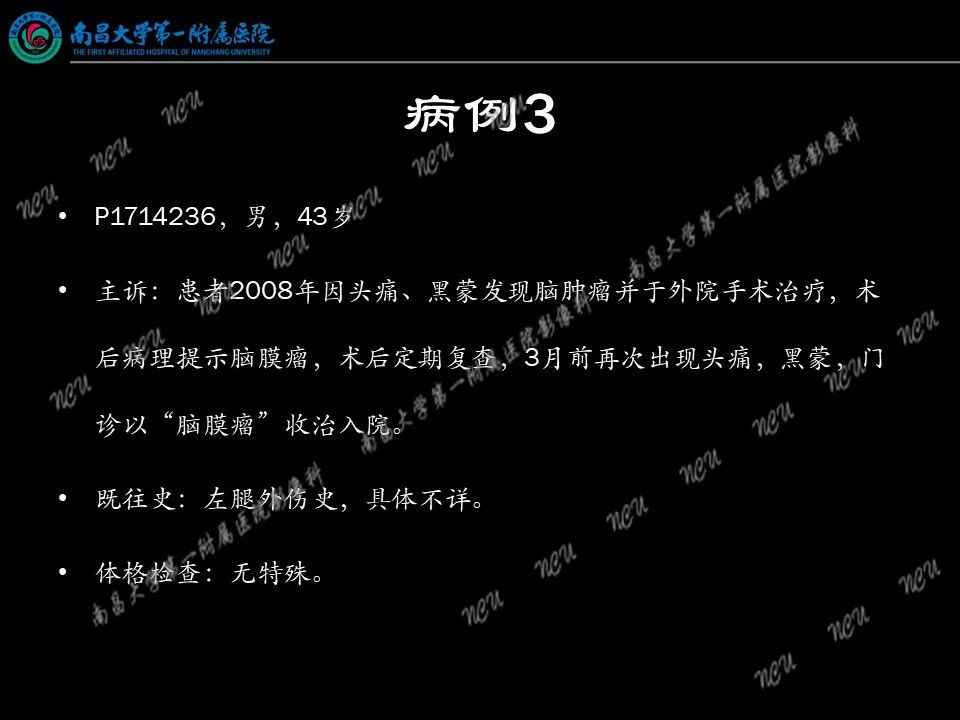 影像PPT - 【PPT】易误诊为脑膜瘤的病例分析-24