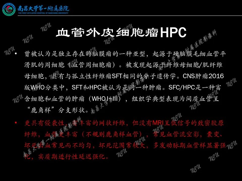 影像PPT - 【PPT】易误诊为脑膜瘤的病例分析-29
