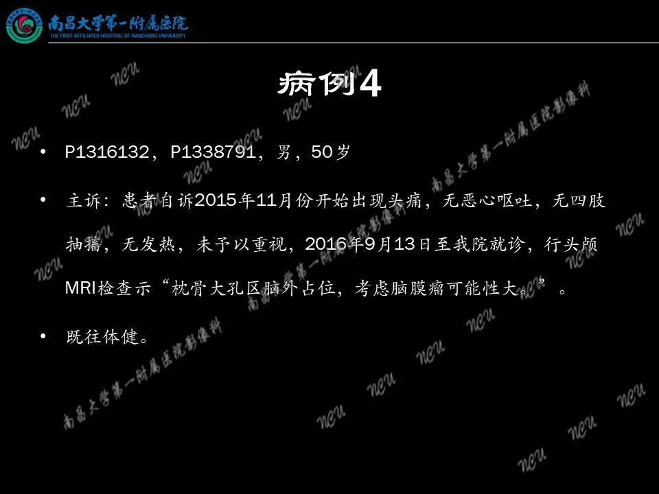 影像PPT - 【PPT】易误诊为脑膜瘤的病例分析-36