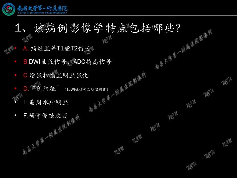 影像PPT - 【PPT】易误诊为脑膜瘤的病例分析-39