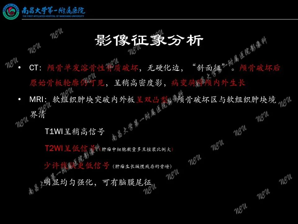 影像PPT - 【PPT】易误诊为脑膜瘤的病例分析-60