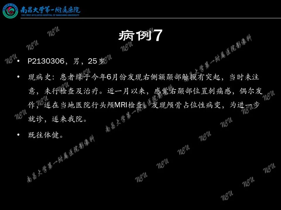 影像PPT - 【PPT】易误诊为脑膜瘤的病例分析-61