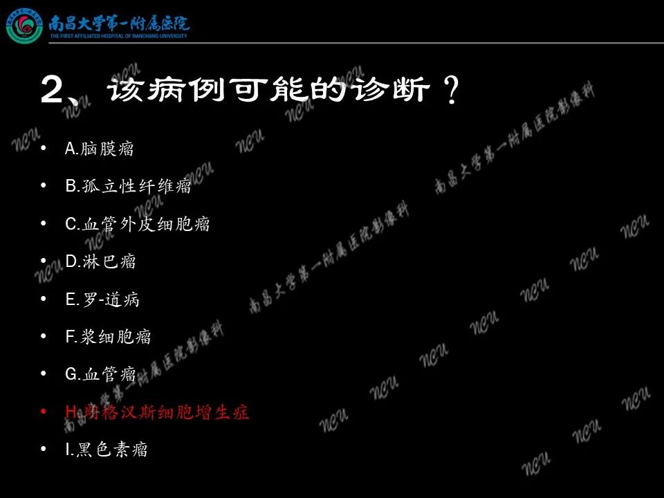 影像PPT - 【PPT】易误诊为脑膜瘤的病例分析-64