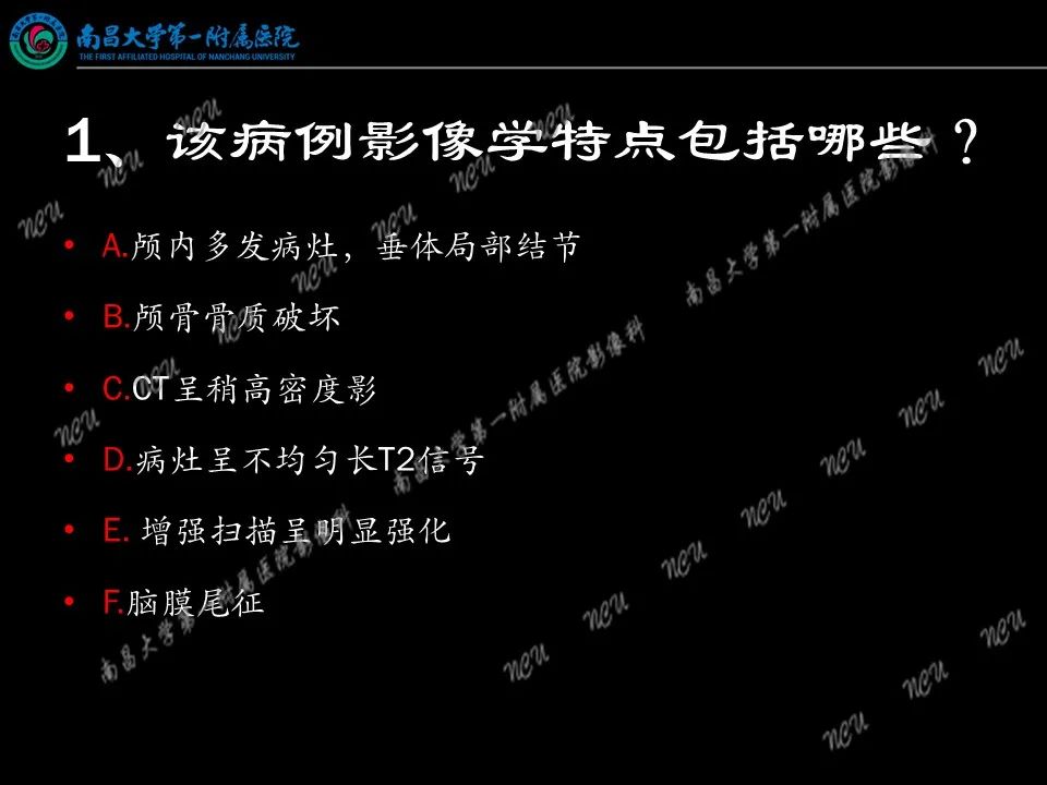 影像PPT - 【PPT】易误诊为脑膜瘤的病例分析-63