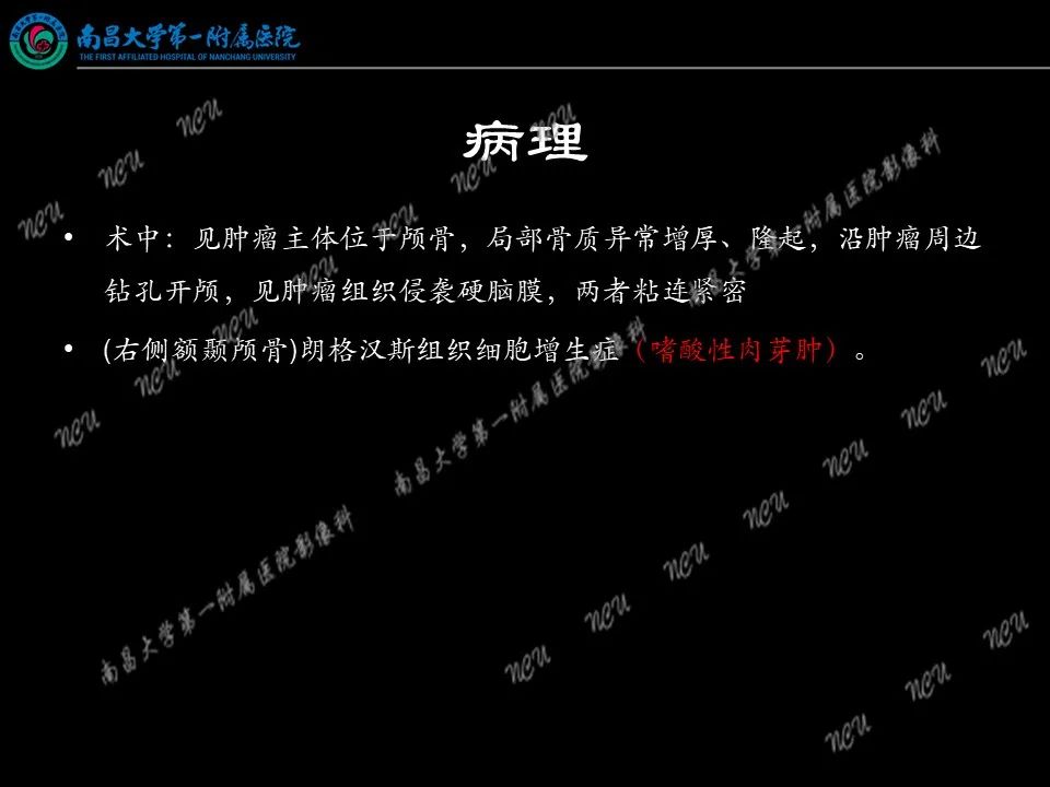 影像PPT - 【PPT】易误诊为脑膜瘤的病例分析-65