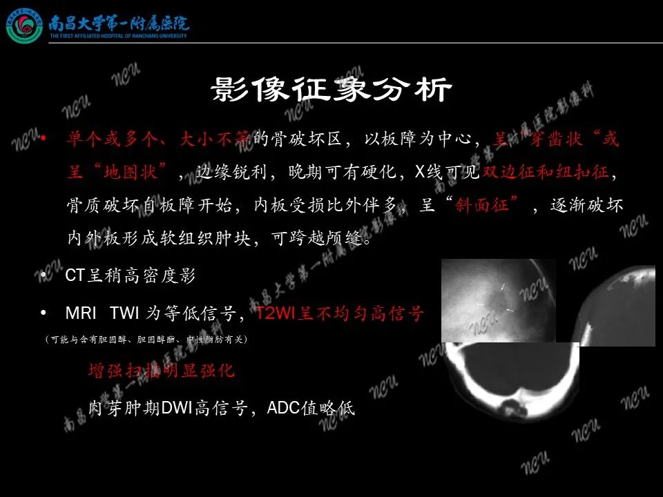 影像PPT - 【PPT】易误诊为脑膜瘤的病例分析-67