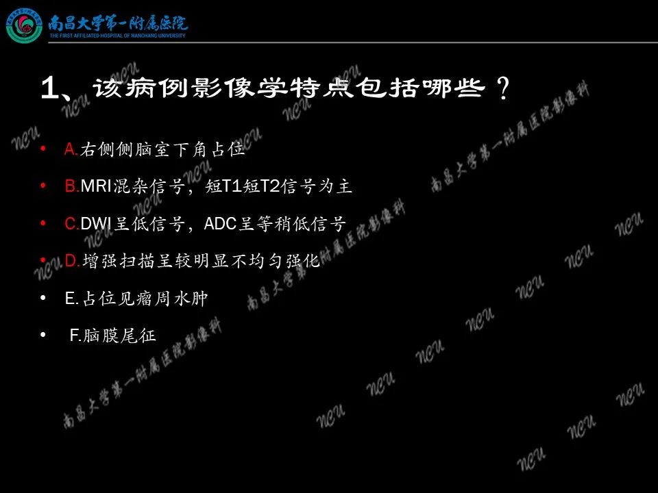 影像PPT - 【PPT】易误诊为脑膜瘤的病例分析-71
