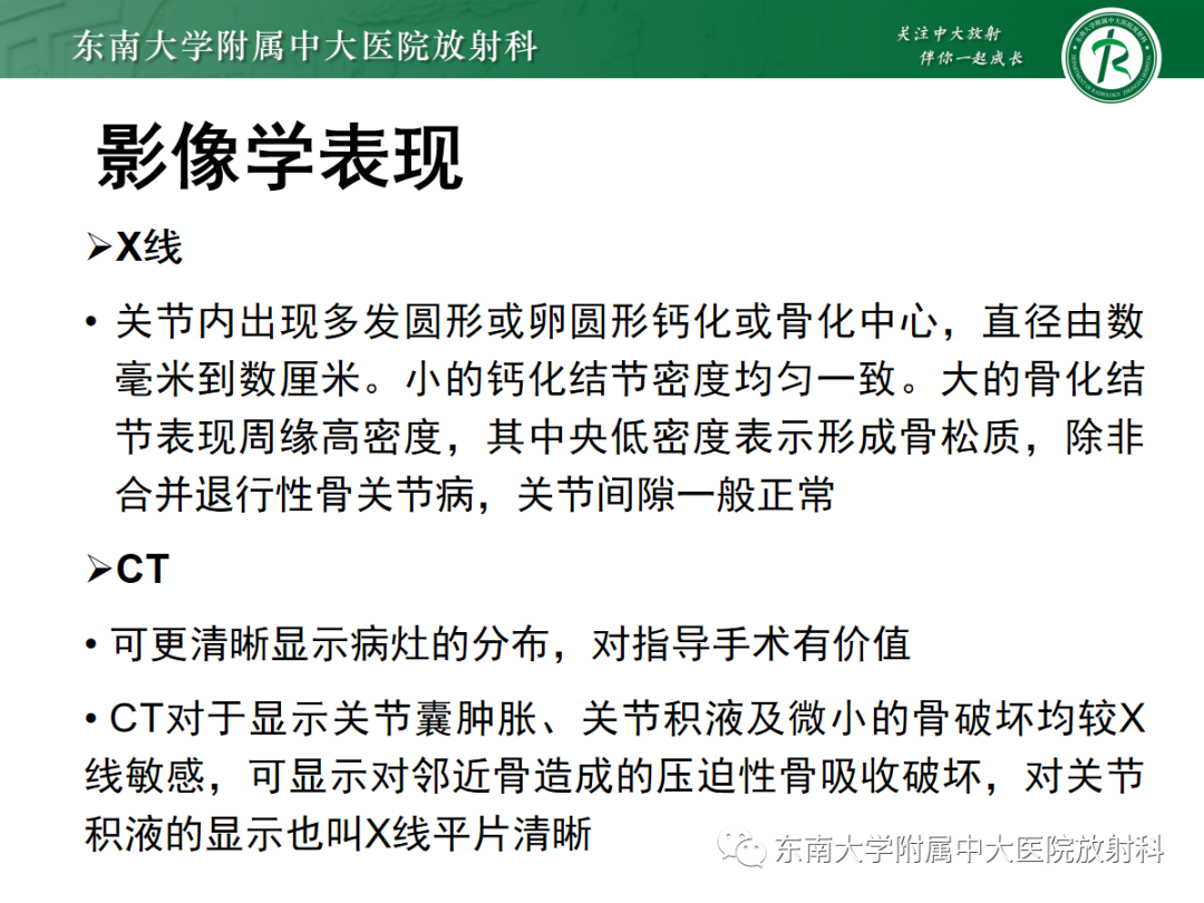 影像PPT - 【PPT】滑膜骨软骨瘤病-7 影像PPT - 【PPT】滑膜骨软骨瘤病-7