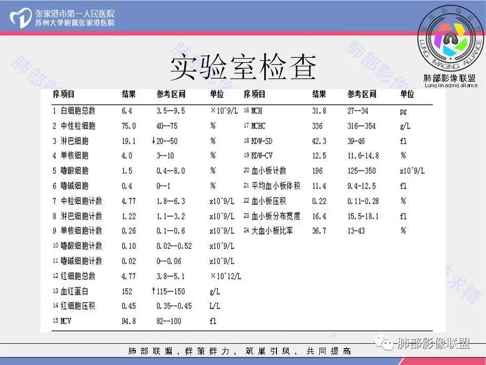影像PPT - 【病例】肺炎性肉芽肿1例CT影像-4 影像PPT - 【病例】肺炎性肉芽肿1例CT影像-4