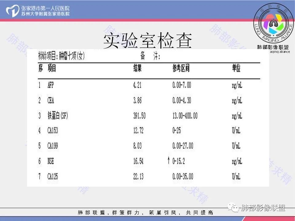 影像PPT - 【病例】肺炎性肉芽肿1例CT影像-3 影像PPT - 【病例】肺炎性肉芽肿1例CT影像-3
