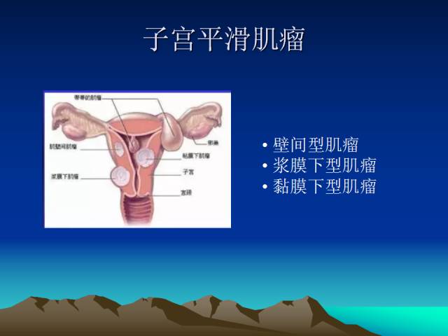 影像PPT - 【PPT】子宫常见疾病的MRI诊断-12