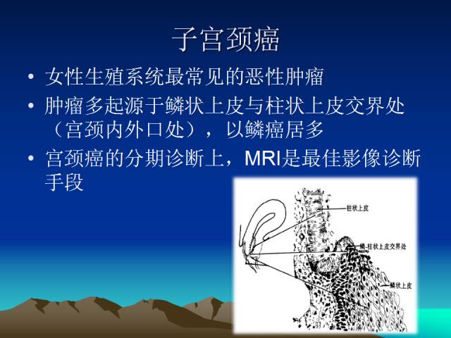 影像PPT - 【PPT】子宫常见疾病的MRI诊断-23