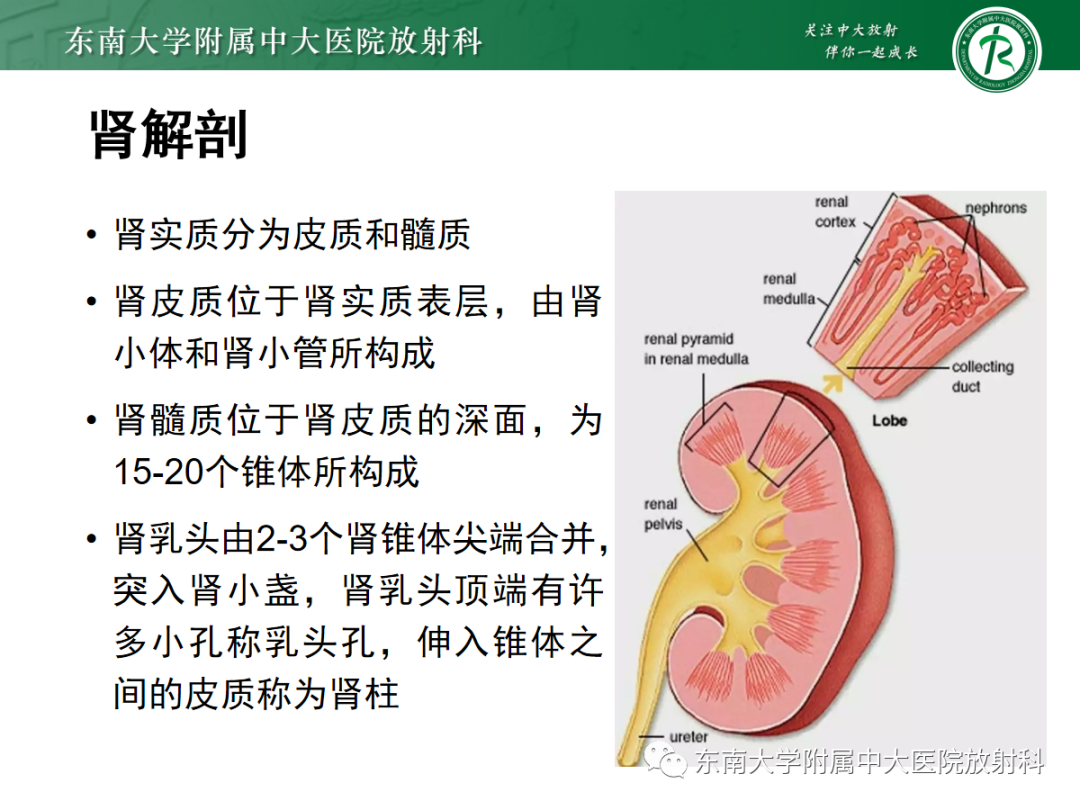 影像PPT - 【PPT】髓质海绵肾-6