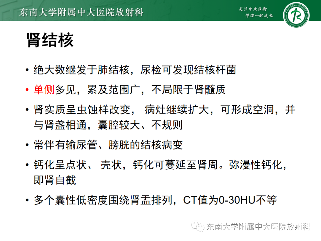 影像PPT - 【PPT】髓质海绵肾-22