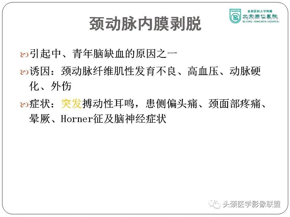 影像PPT - 【PPT】搏动性耳鸣诊疗进展-13