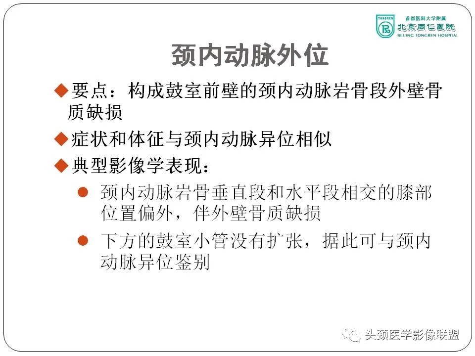 影像PPT - 【PPT】搏动性耳鸣诊疗进展-16