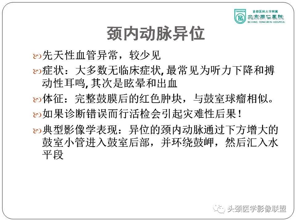 影像PPT - 【PPT】搏动性耳鸣诊疗进展-14