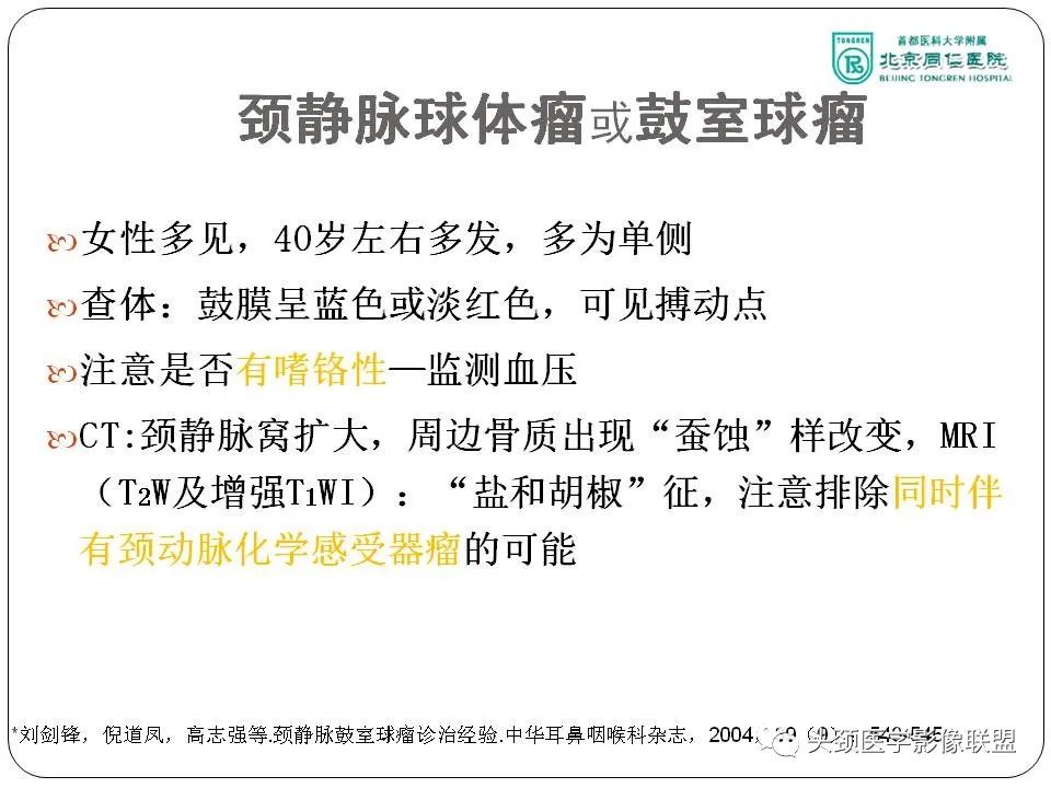 影像PPT - 【PPT】搏动性耳鸣诊疗进展-21