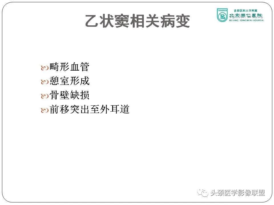影像PPT - 【PPT】搏动性耳鸣诊疗进展-33